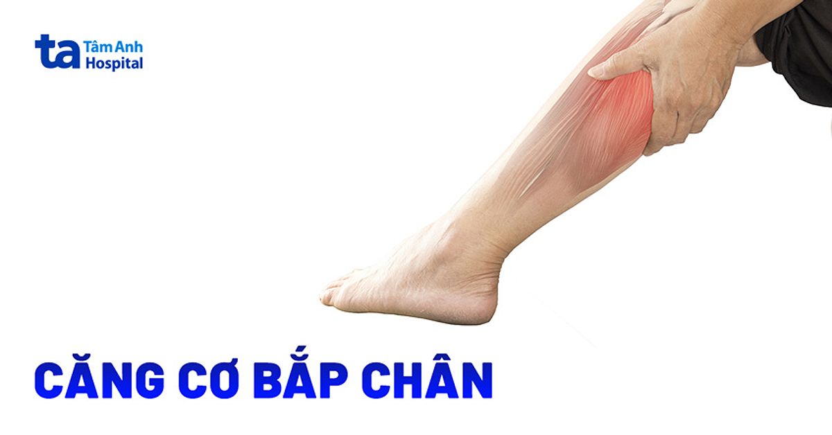 Hình ảnh minh họa về tình trạng căng cơ bắp chân, cho thấy vùng cơ bị ảnh hưởng.